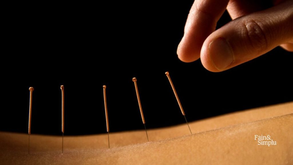 Tratamentul prin acupunctură: Riscuri și beneficii